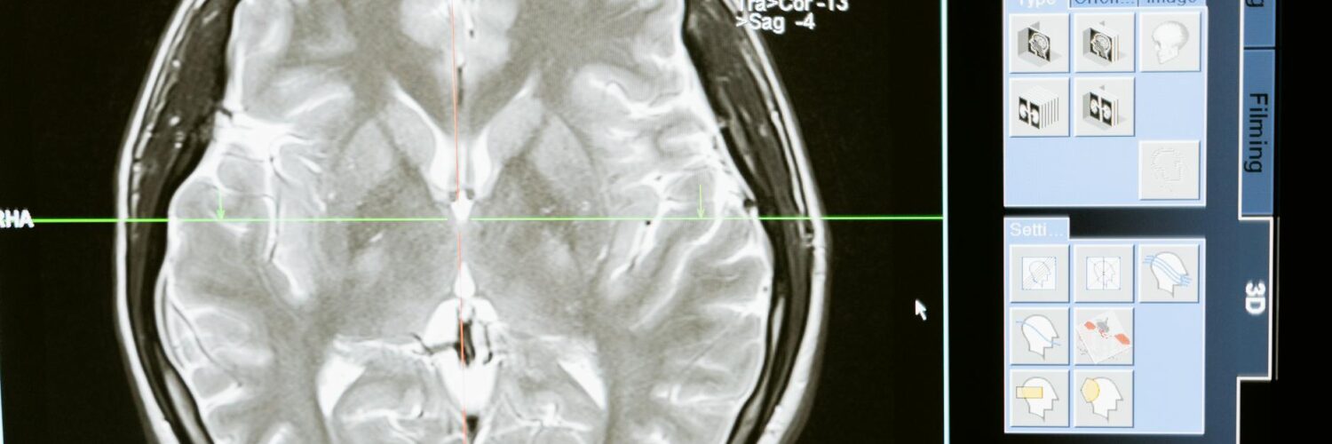 The Everyday Mind: Unpacking Our Hidden Thinking, Feeling, and Acting Patterns