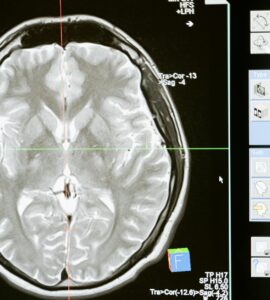 The Everyday Mind: Unpacking Our Hidden Thinking, Feeling, and Acting Patterns