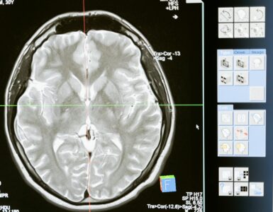 The Everyday Mind: Unpacking Our Hidden Thinking, Feeling, and Acting Patterns